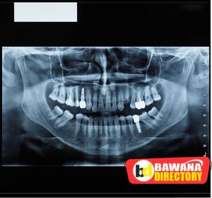 Dental x-ray